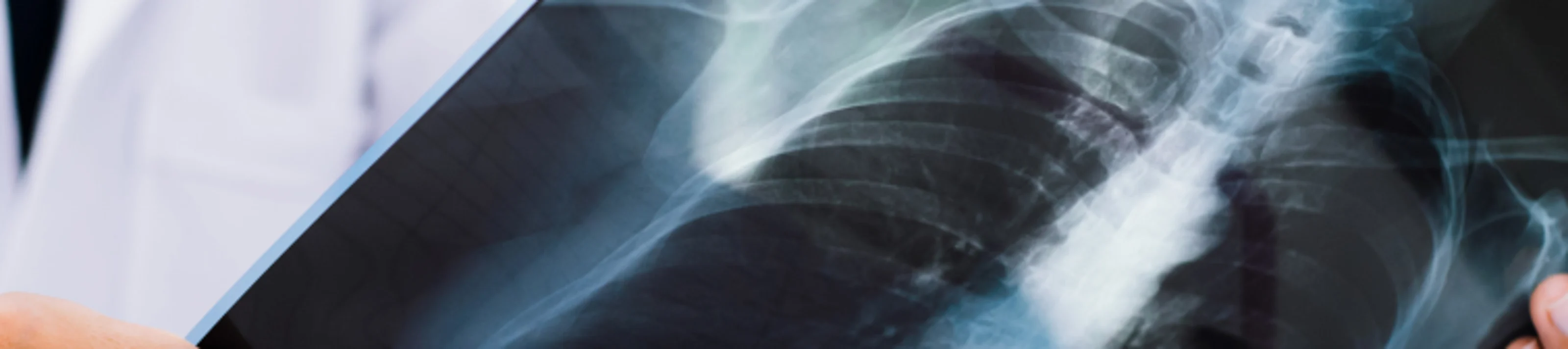 Banner hero seguridad
